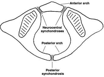 Posterior arch anomalies of Atlas and its clinical significance