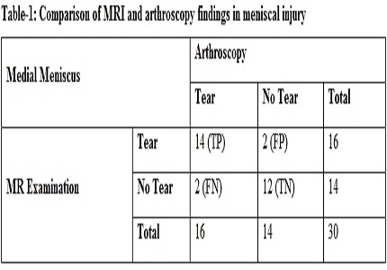 A comparative study of MRI versus arthroscopic findings in meniscal injuries of knee